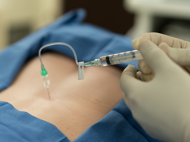 Therapeutic Injections