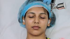 Hydrafacial
