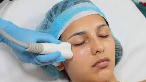 RF Cautery