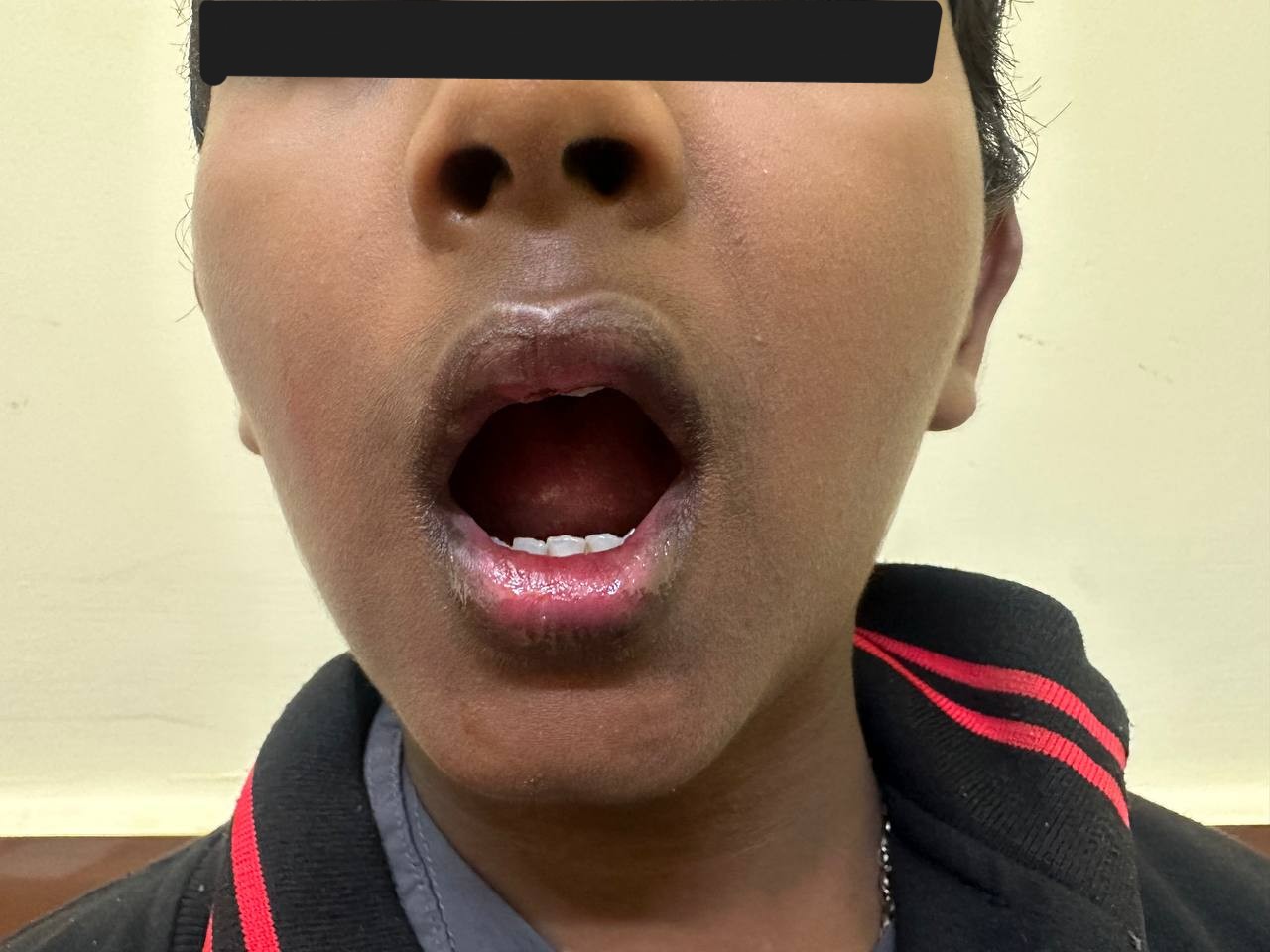 After